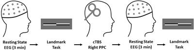 Parietal Cortex Connectivity as a Marker of Shift in Spatial Attention Following Continuous Theta Burst Stimulation